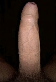 Milton Escort Masculino